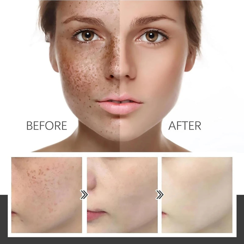 Aobenz Anti Spot Serum