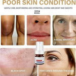 Aobenz Anti Spot Serum